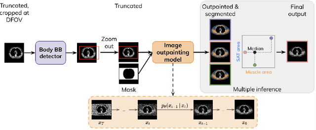 Figure 1 for Diffusion-based Generative Image Outpainting for Recovery of FOV-Truncated CT Images