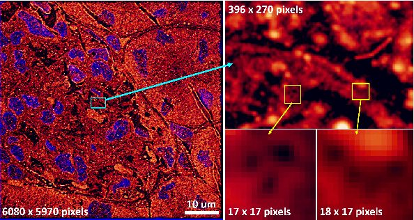 Figure 1 for Patch Gradient Descent: Training Neural Networks on Very Large Images