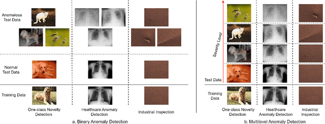 Figure 1 for Are Anomaly Scores Telling the Whole Story? A Benchmark for Multilevel Anomaly Detection