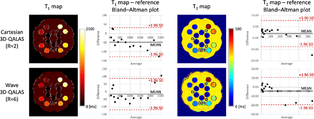 Figure 2 for Time-efficient, High Resolution 3T Whole Brain Quantitative Relaxometry using 3D-QALAS with Wave-CAIPI Readouts
