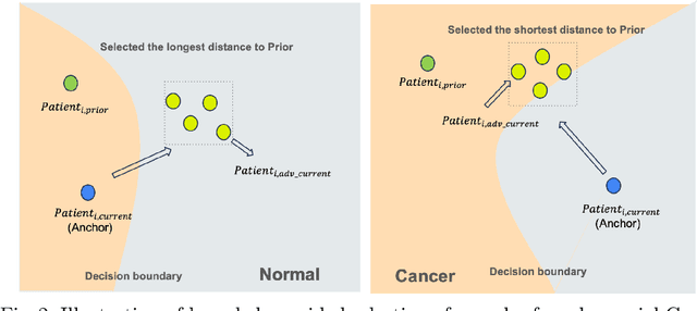 Figure 3 for Longitudinal Mammogram Exam-based Breast Cancer Diagnosis Models: Vulnerability to Adversarial Attacks