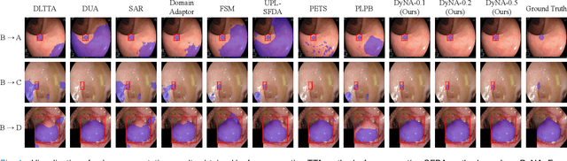 Figure 3 for Day-Night Adaptation: An Innovative Source-free Adaptation Framework for Medical Image Segmentation