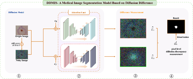 Figure 1 for DiffSeg: A Segmentation Model for Skin Lesions Based on Diffusion Difference