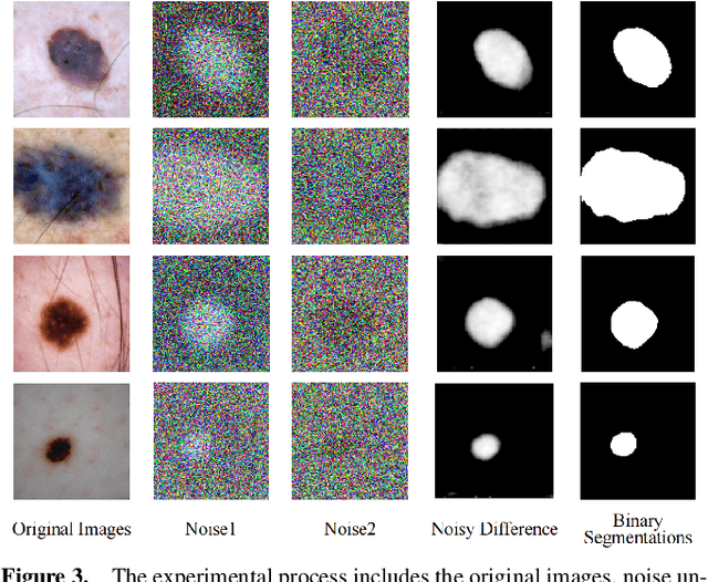 Figure 3 for DiffSeg: A Segmentation Model for Skin Lesions Based on Diffusion Difference