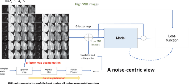 Figure 1 for Imaging transformer for MRI denoising with the SNR unit training: enabling generalization across field-strengths, imaging contrasts, and anatomy