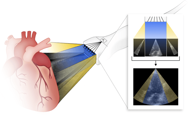 Figure 1 for Generative Adversarial Networks in Ultrasound Imaging: Extending Field of View Beyond Conventional Limits