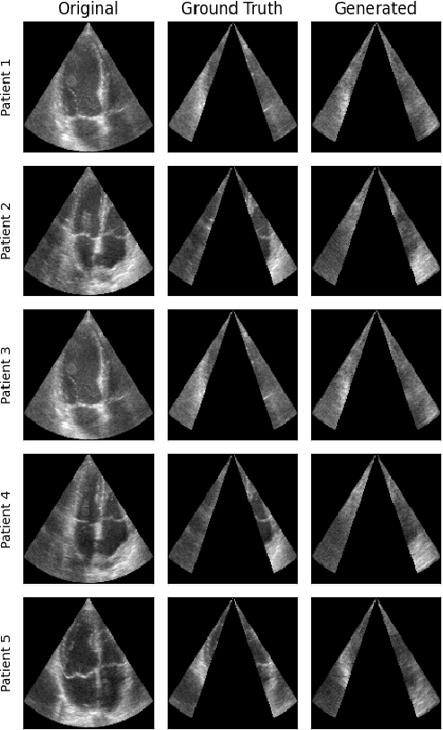 Figure 3 for Generative Adversarial Networks in Ultrasound Imaging: Extending Field of View Beyond Conventional Limits