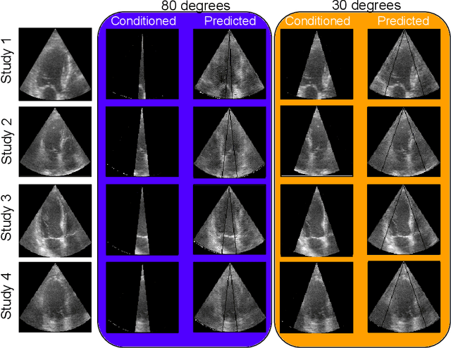 Figure 4 for Generative Adversarial Networks in Ultrasound Imaging: Extending Field of View Beyond Conventional Limits