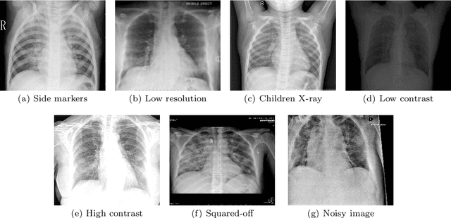 Figure 2 for CoVScreen: Pitfalls and recommendations for screening COVID-19 using Chest X-rays