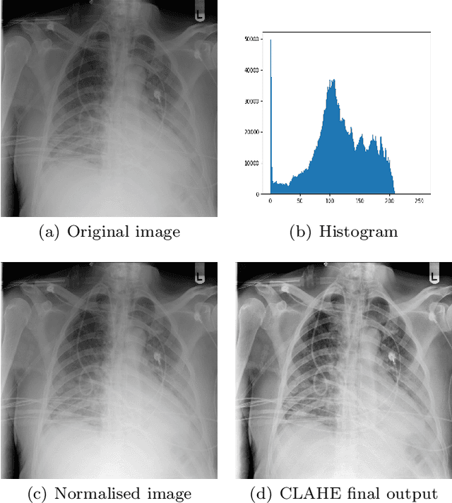 Figure 3 for CoVScreen: Pitfalls and recommendations for screening COVID-19 using Chest X-rays