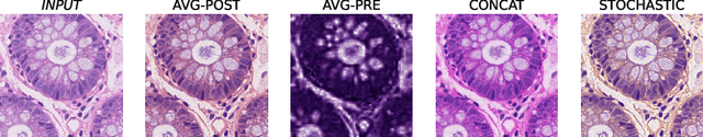 Figure 3 for Multi-target stain normalization for histology slides