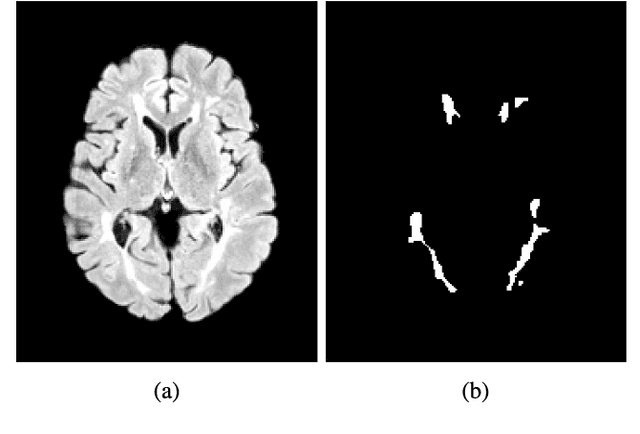 Figure 3 for Boosting multiple sclerosis lesion segmentation through attention mechanism