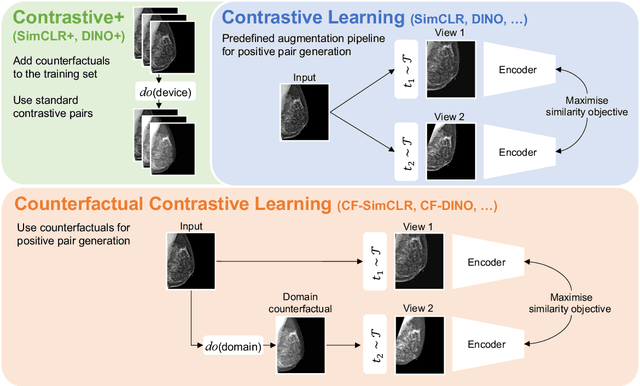 Figure 1 for Robust image representations with counterfactual contrastive learning