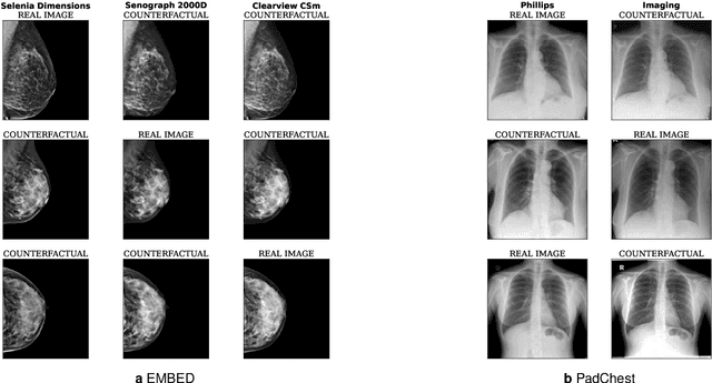 Figure 3 for Robust image representations with counterfactual contrastive learning