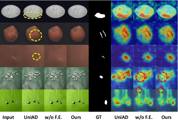 Figure 1 for LafitE: Latent Diffusion Model with Feature Editing for Unsupervised Multi-class Anomaly Detection