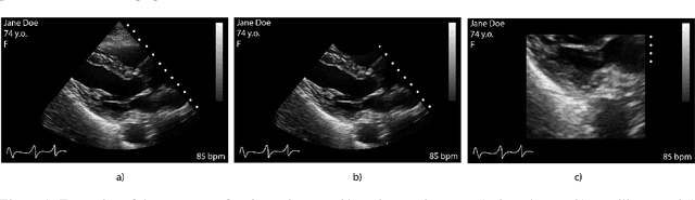 Figure 1 for Medical Image Deidentification, Cleaning and Compression Using Pylogik