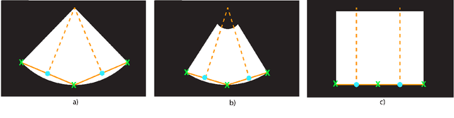 Figure 4 for Medical Image Deidentification, Cleaning and Compression Using Pylogik