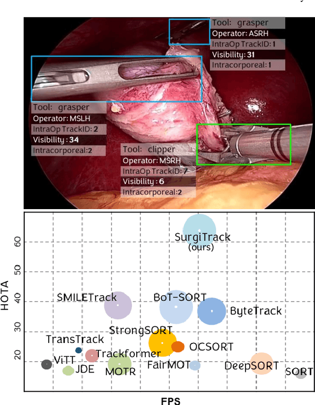 Figure 1 for SurgiTrack: Fine-Grained Multi-Class Multi-Tool Tracking in Surgical Videos