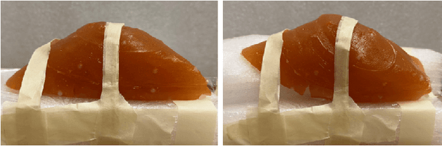 Figure 3 for Boundary Constraint-free Biomechanical Model-Based Surface Matching for Intraoperative Liver Deformation Correction