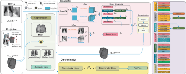 Figure 1 for DuoLift-GAN:Reconstructing CT from Single-view and Biplanar X-Rays with Generative Adversarial Networks