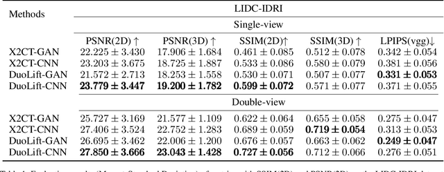 Figure 2 for DuoLift-GAN:Reconstructing CT from Single-view and Biplanar X-Rays with Generative Adversarial Networks