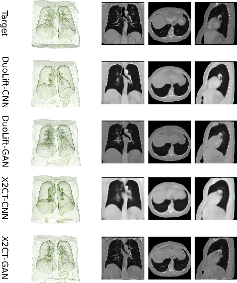 Figure 4 for DuoLift-GAN:Reconstructing CT from Single-view and Biplanar X-Rays with Generative Adversarial Networks