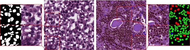 Figure 3 for Channel Boosted CNN-Transformer-based Multi-Level and Multi-Scale Nuclei Segmentation