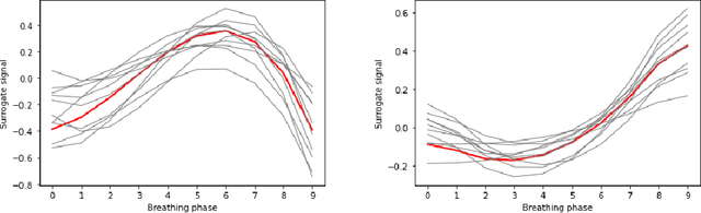 Figure 3 for Deep-Motion-Net: GNN-based volumetric organ shape reconstruction from single-view 2D projections