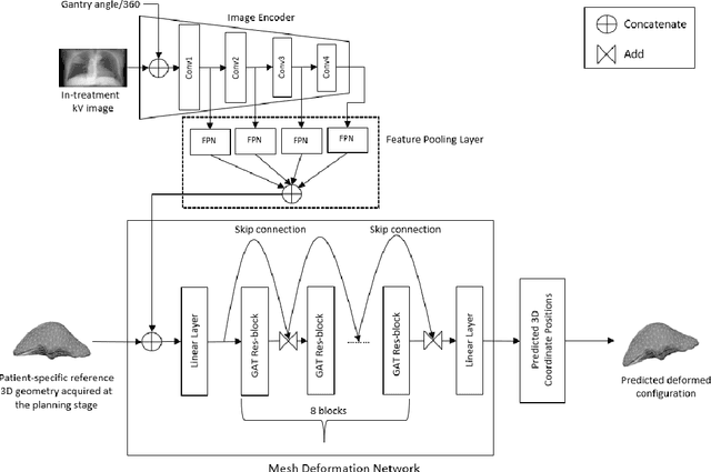 Figure 1 for Deep-Motion-Net: GNN-based volumetric organ shape reconstruction from single-view 2D projections