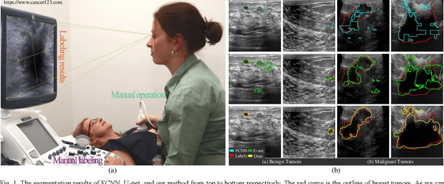 Figure 1 for ESKNet-An enhanced adaptive selection kernel convolution for breast tumors segmentation