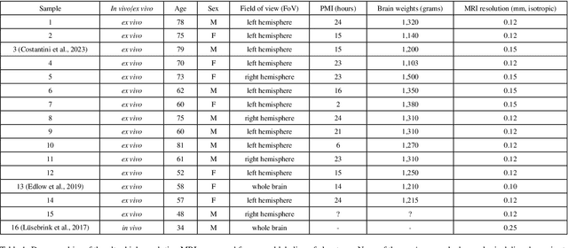 Figure 1 for A Constrast-Agnostic Method for Ultra-High Resolution Claustrum Segmentation