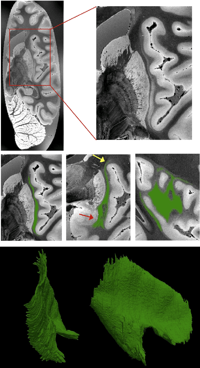 Figure 2 for A Constrast-Agnostic Method for Ultra-High Resolution Claustrum Segmentation