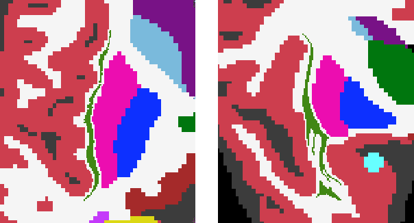 Figure 3 for A Constrast-Agnostic Method for Ultra-High Resolution Claustrum Segmentation