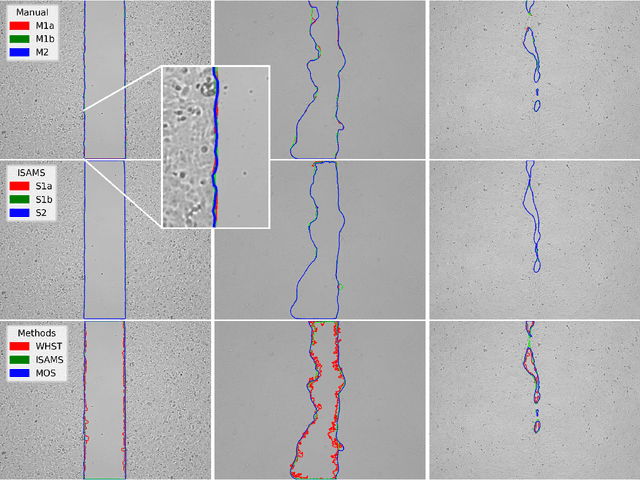 Figure 4 for Virtually Objective Quantification of in vitro Wound Healing Scratch Assays with the Segment Anything Model