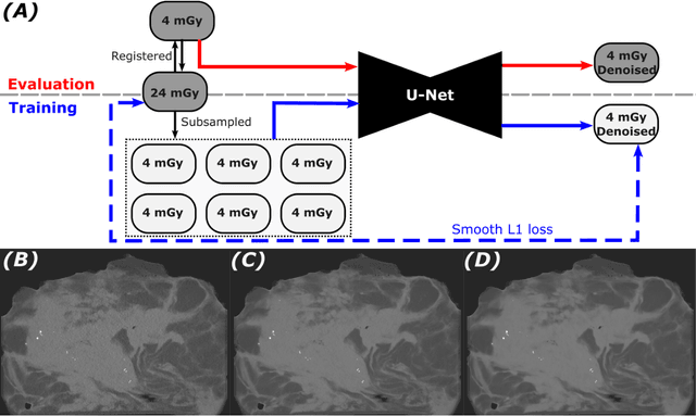 Figure 4 for Towards order of magnitude X-ray dose reduction in breast cancer imaging using phase contrast and deep denoising