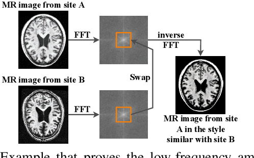 Figure 1 for FAN-Net: Fourier-Based Adaptive Normalization For Cross-Domain Stroke Lesion Segmentation