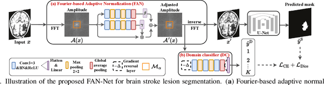 Figure 3 for FAN-Net: Fourier-Based Adaptive Normalization For Cross-Domain Stroke Lesion Segmentation