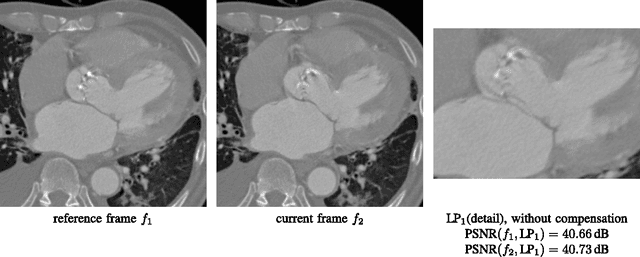 Figure 2 for Temporal Scalability of Dynamic Volume Data Using Mesh Compensated Wavelet Lifting
