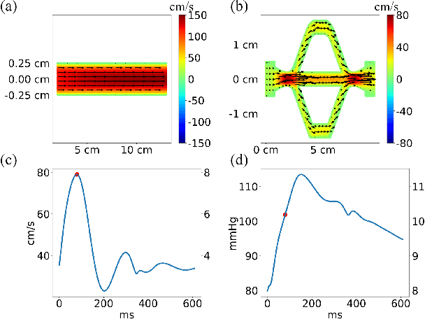 Figure 2 for Towards Real-time Training of Physics-informed Neural Networks: Applications in Ultrafast Ultrasound Blood Flow Imaging