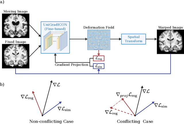 Figure 1 for Improving Instance Optimization in Deformable Image Registration with Gradient Projection