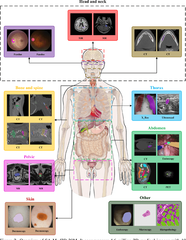 Figure 3 for SA-Med2D-20M Dataset: Segment Anything in 2D Medical Imaging with 20 Million masks