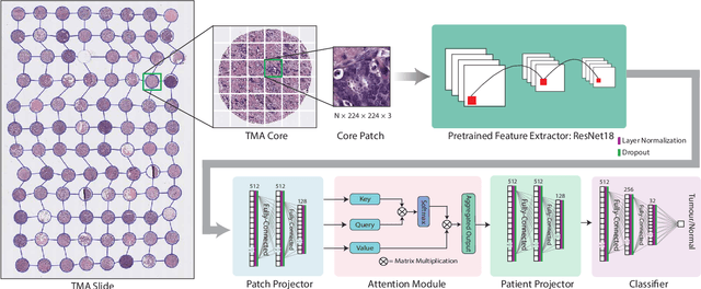 Figure 1 for GRAPHITE: Graph-Based Interpretable Tissue Examination for Enhanced Explainability in Breast Cancer Histopathology