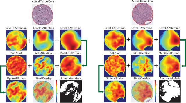 Figure 4 for GRAPHITE: Graph-Based Interpretable Tissue Examination for Enhanced Explainability in Breast Cancer Histopathology