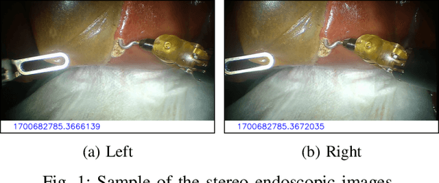 Figure 1 for Expanded Comprehensive Robotic Cholecystectomy Dataset (CRCD)