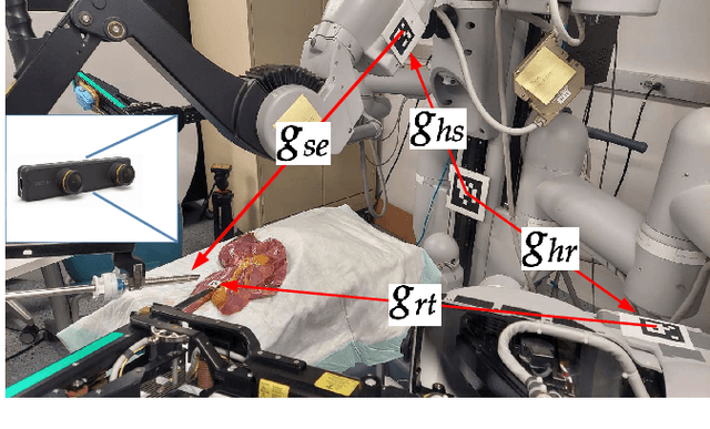 Figure 4 for Expanded Comprehensive Robotic Cholecystectomy Dataset (CRCD)