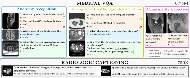 Figure 1 for RadImageNet-VQA: A Large-Scale CT and MRI Dataset for Radiologic Visual Question Answering