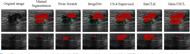 Figure 4 for Generating and Weighting Semantically Consistent Sample Pairs for Ultrasound Contrastive Learning