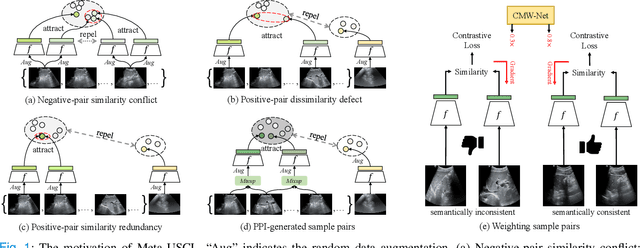 Figure 1 for Generating and Weighting Semantically Consistent Sample Pairs for Ultrasound Contrastive Learning