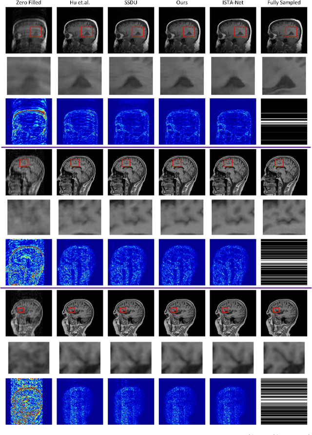 Figure 4 for Exploring Siamese Networks in Self-Supervised Fast MRI Reconstruction