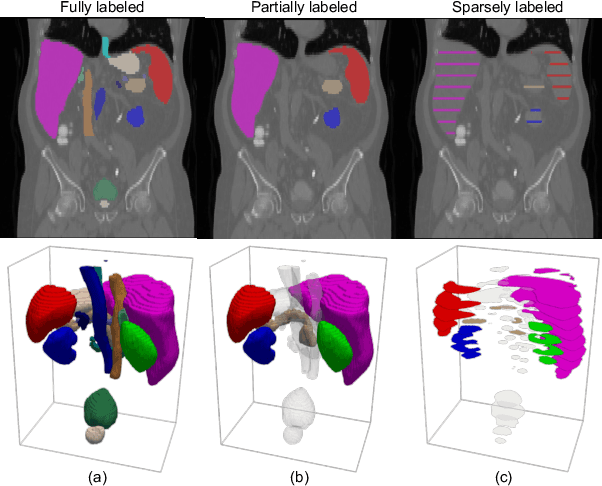 Figure 1 for Versatile Medical Image Segmentation Learned from Multi-Source Datasets via Model Self-Disambiguation